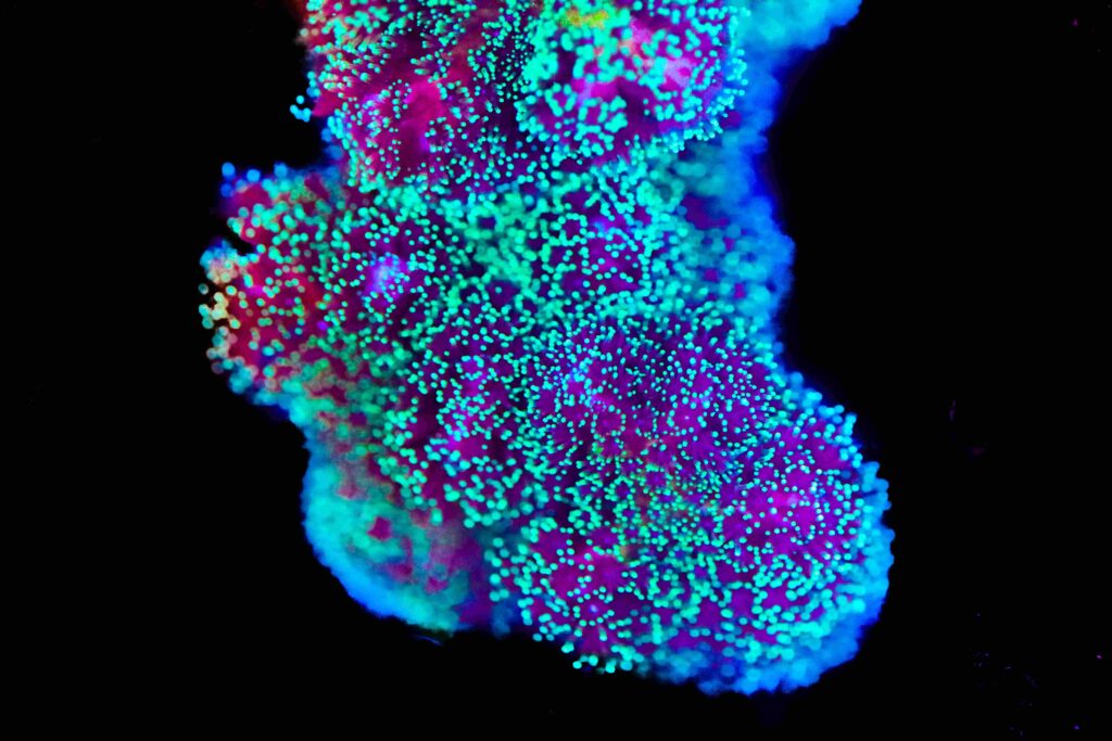 Frag Box Corals